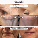 Sadoer Freeze-Dried Collagen by Talora™ For visibly firmer and radiant skin in just 14 days