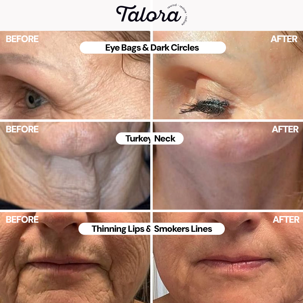 Sadoer Freeze-Dried Collagen by Talora™ For visibly firmer and radiant skin in just 14 days